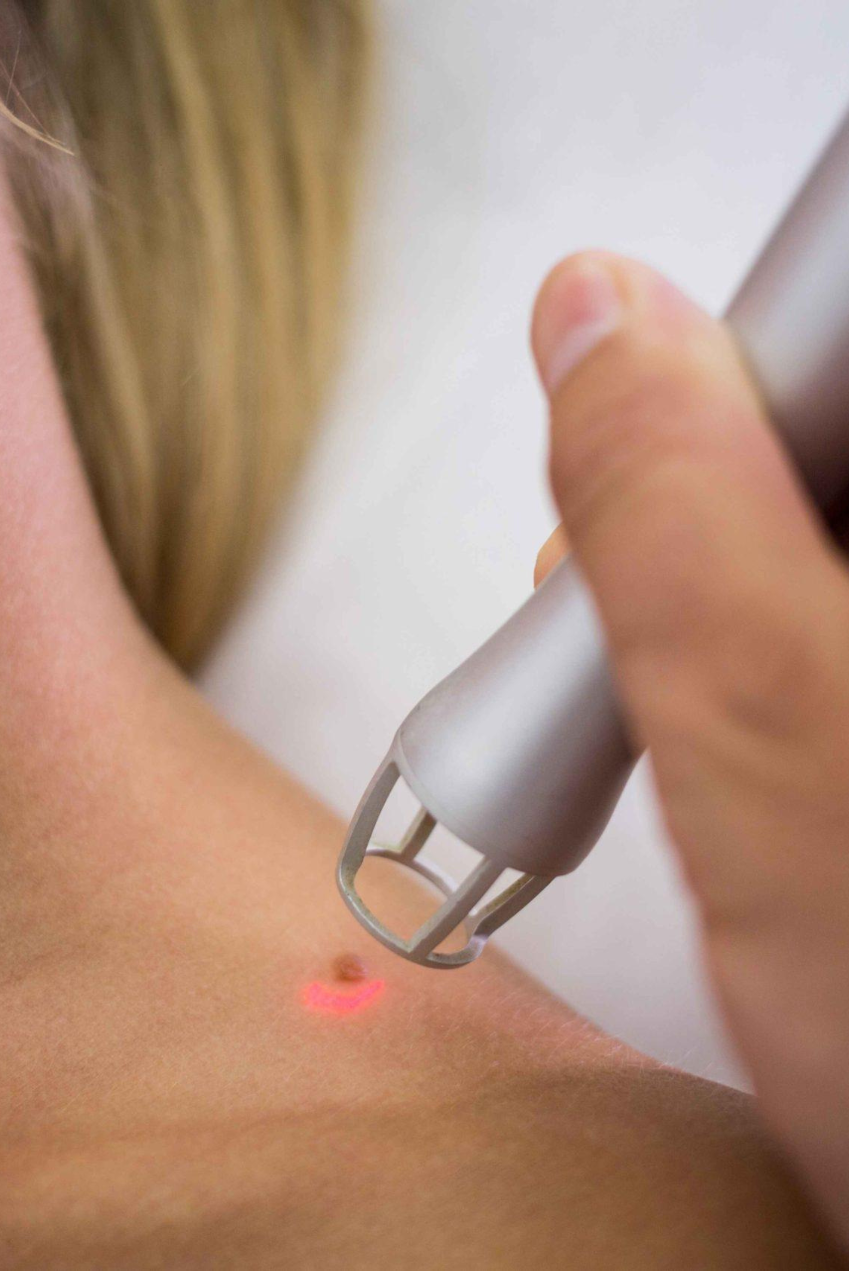 Skin Specialist in Raipur