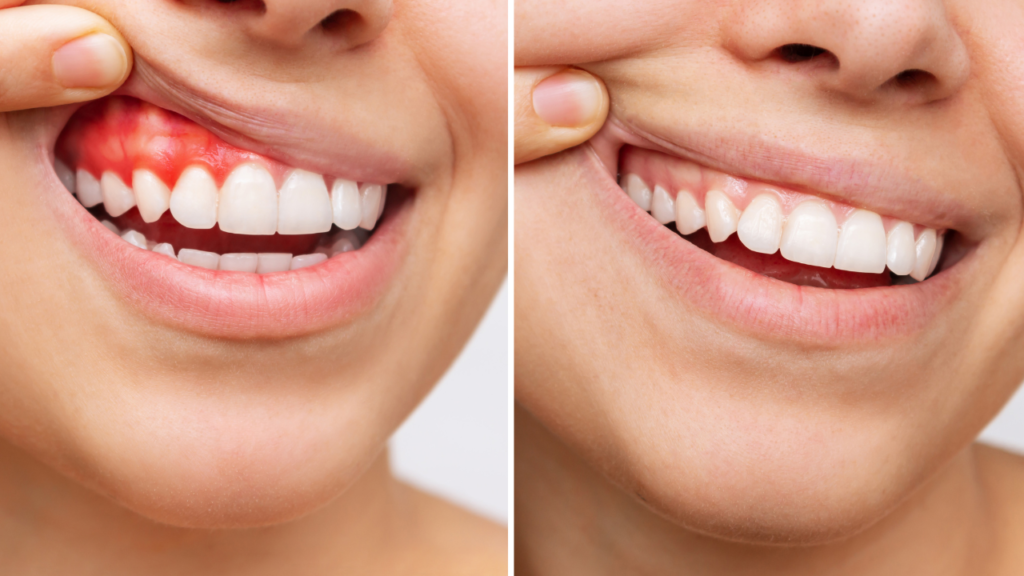 Teeth Specialist in Raipur