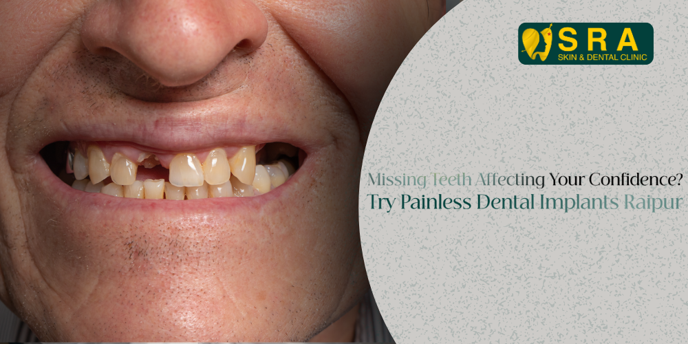 Painless Dental Implants Raipur