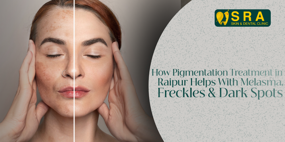 Pigmentation Treatment in Raipur