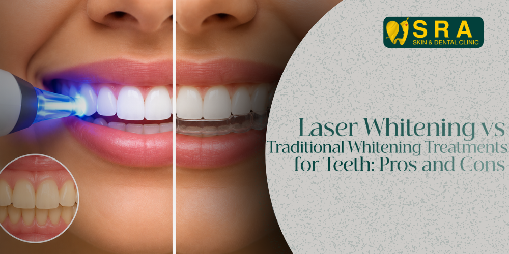Whitening Treatments for Teeth